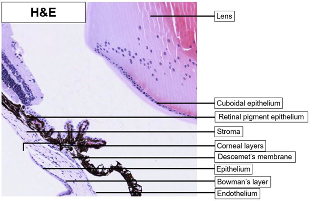 eye_cornea_he_01.jpg