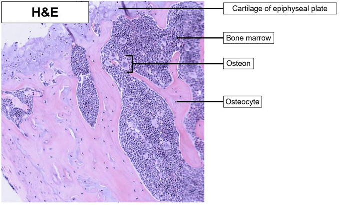 femur_epiphysis_he_01.JPG