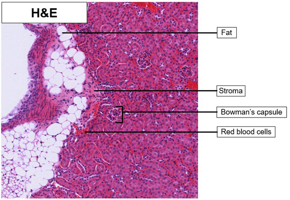 kidney_he_02.jpg