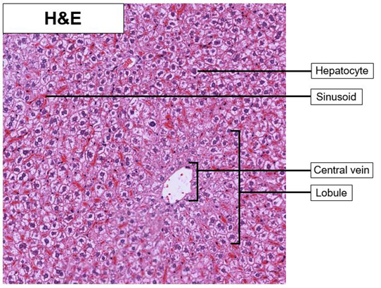 liver_he_01.jpg