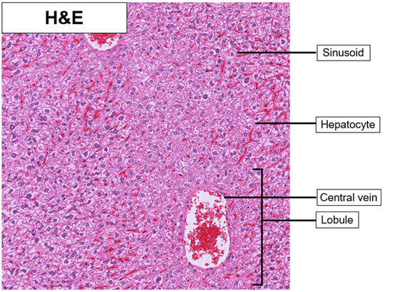 liver_he_02.jpg