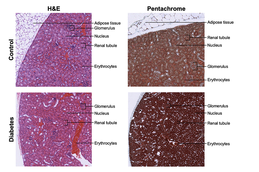 kidney