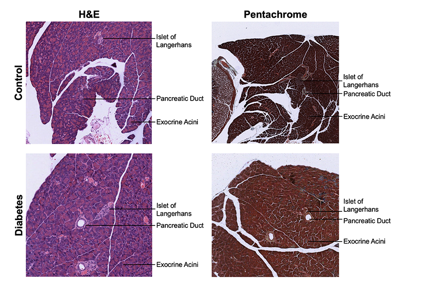 pancreas