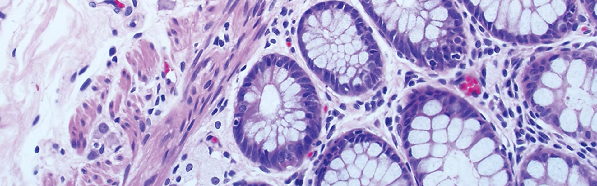 Put new alt tag here