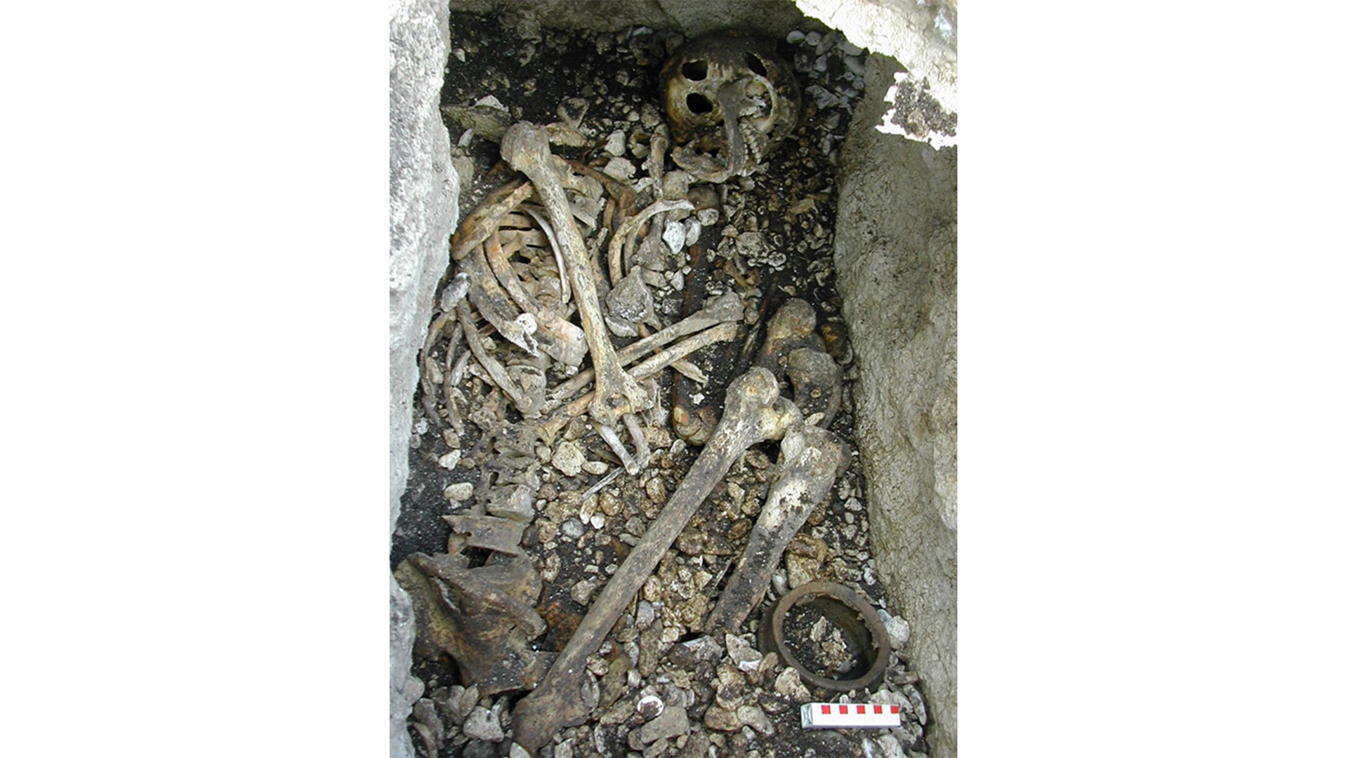 Haemochromatosis---burial-site---Lancet.jpg