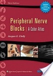 peripheral-nerve-block