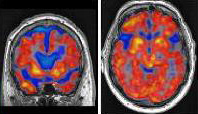 Neuromflammation-image.jpg