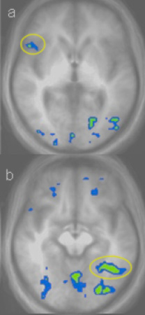 FMRI-Image-narrowabc.jpg