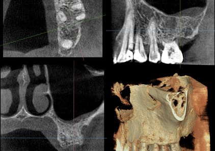 Multiple views of a dental CBCT scan
