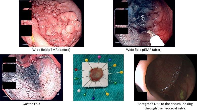 Photos of work completed by program