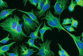 Microscopic view of fluorescently stained cells, showing green cell structures and bright blue nuclei.