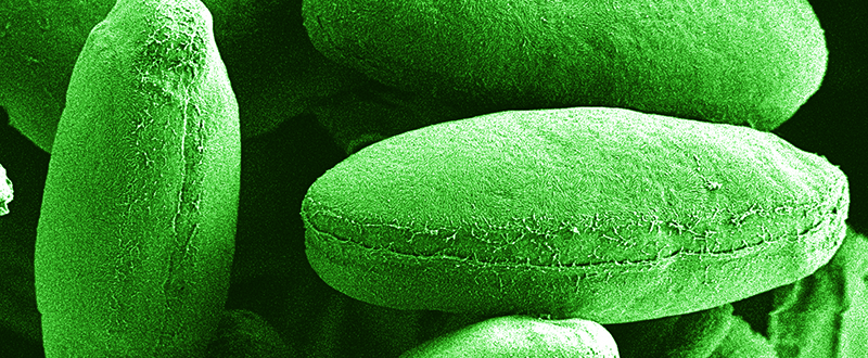Image of Algae under high magnification