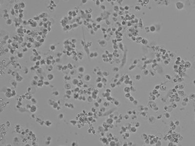 ImPaKT-microscope-image-of-SARS-COV-2-infecting-cells.jpg