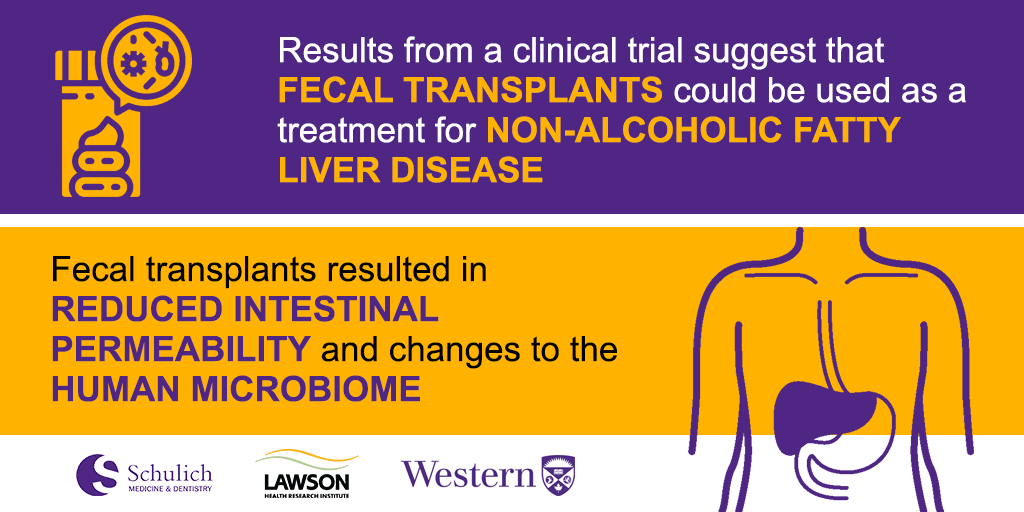 Graphic: Results from a clinical trial suggest that fecal transplants could be used as a treatment for non-alcoholic fatt liver disease. Fecal transplants resulted in reduced intestinal permiability and changes to the microbiome 