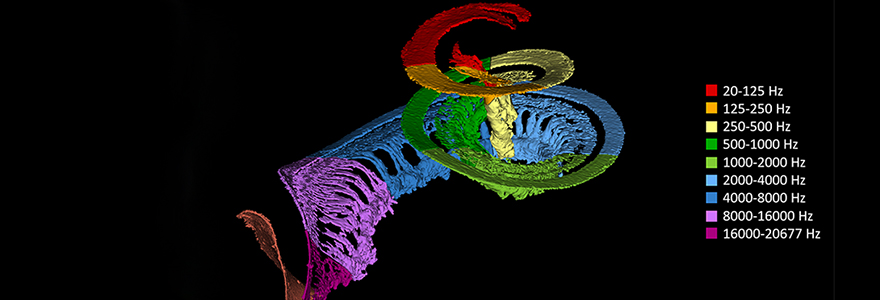 3D model of the basilar membrane, spiral ganglion, and connecting dendrites within the cochlea. The different regions along the cochlear spiral are coloured according to their corresponding pitch/frequency. This image illustrates the ‘spatial pitch distribution’ that exists within the cochlea.