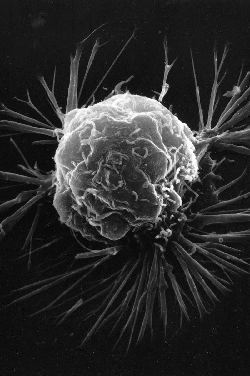 cancer cell