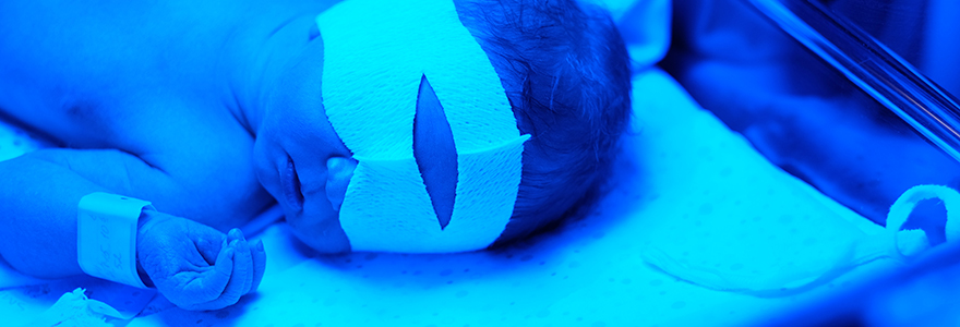 Newborn baby having photo theraphy