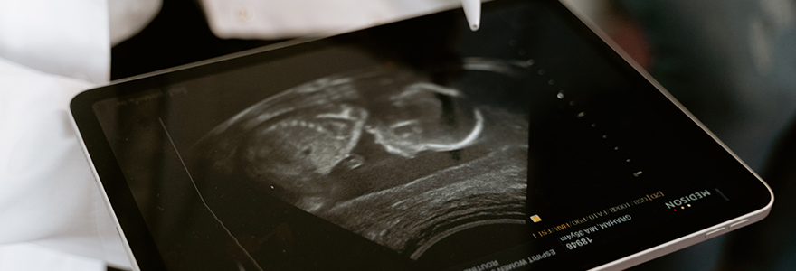 Ultrasound of baby on an ipad