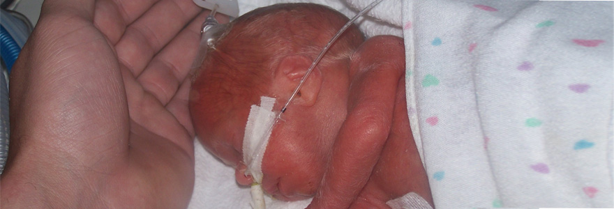 Premature baby in incubator