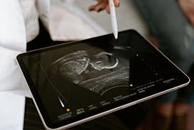 Photograph of baby ultrasound on a ipad