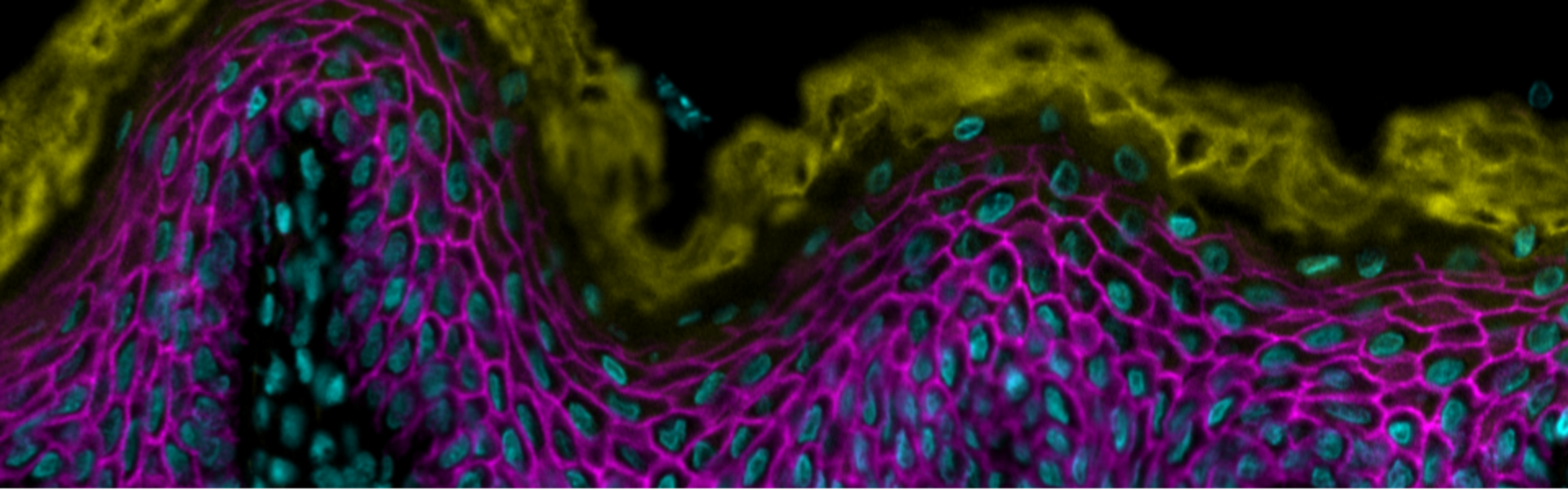 Put new alt tag here