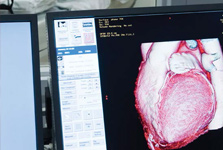 Heart CAT scan