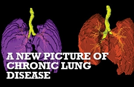 A new picture of chronic lung disease