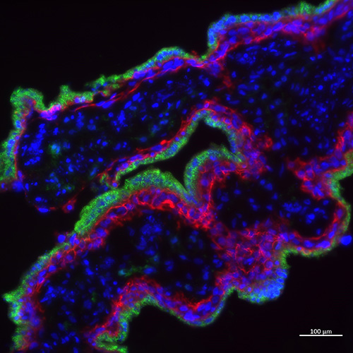 Image of immunofluorescence stain of a human placenta showing different trophoblast subtypes