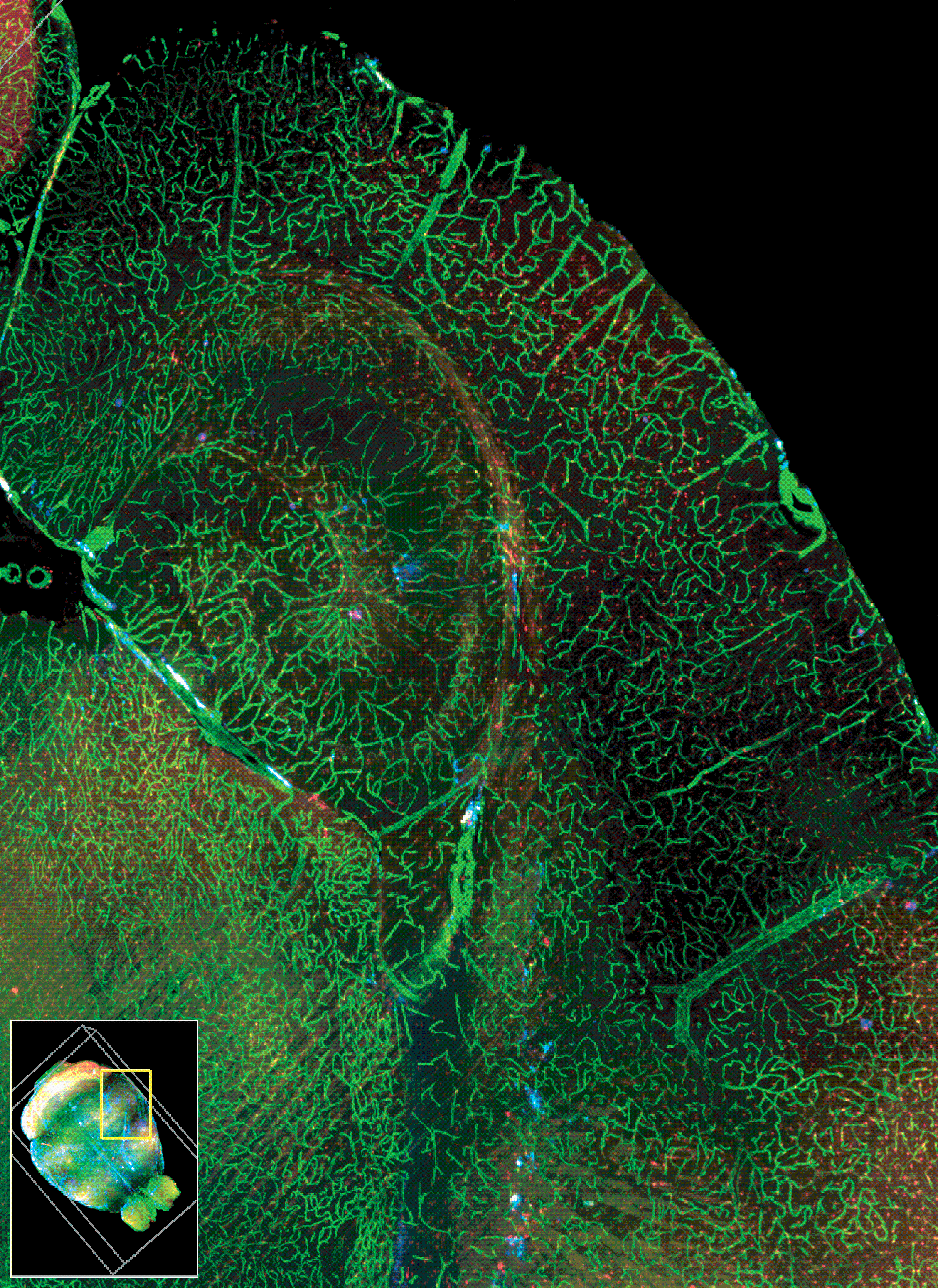 Light sheet microscopy image of a mouse brain showing a dense green network of blood vessels over red amyloid plaques