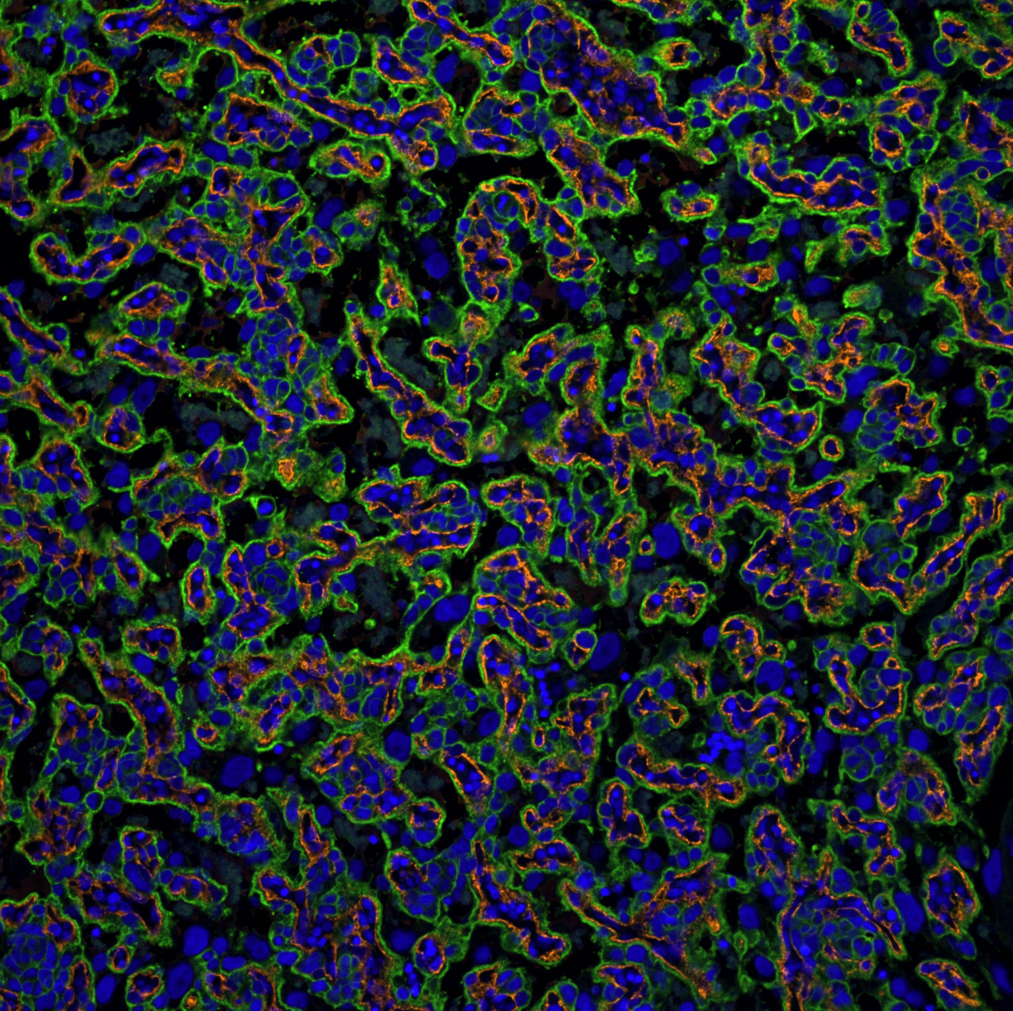 4 female students doing a cultural dance