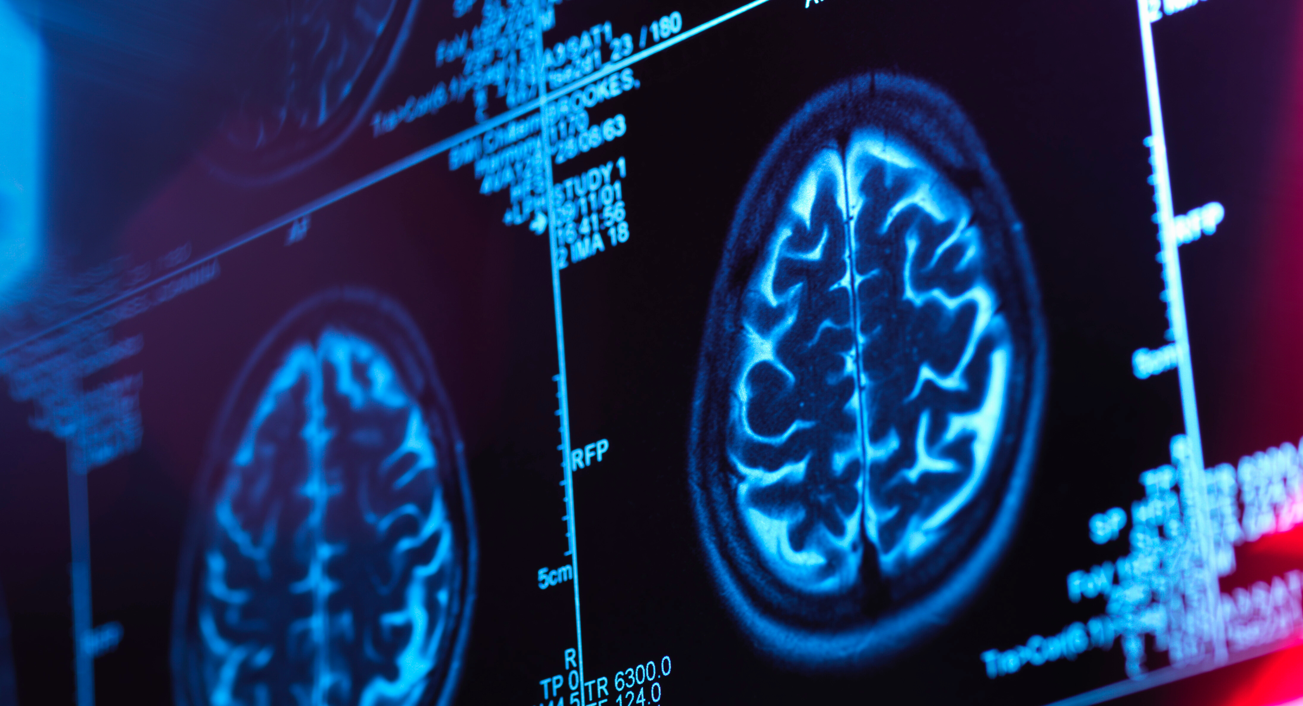 translational neuroscience